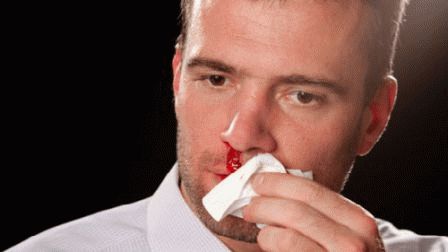Ver una hemorragia nasal en un sueño